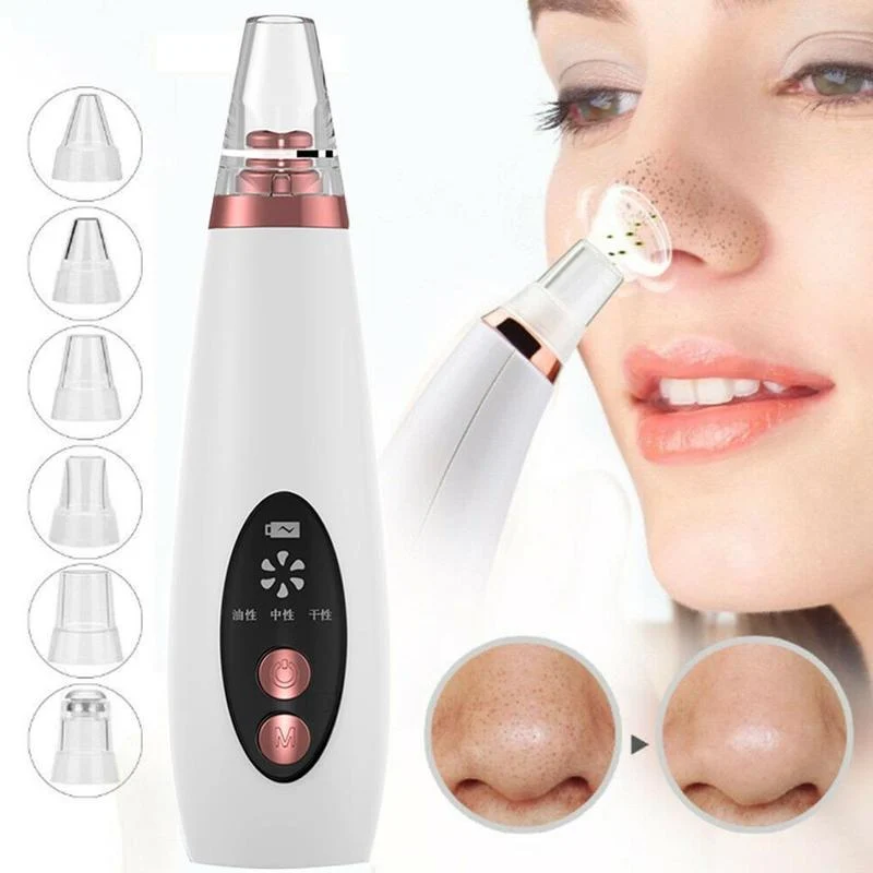 Soft Blackhead Remover Vacuum – Deep Pore Cleansing Tool for Clear Skin Effective