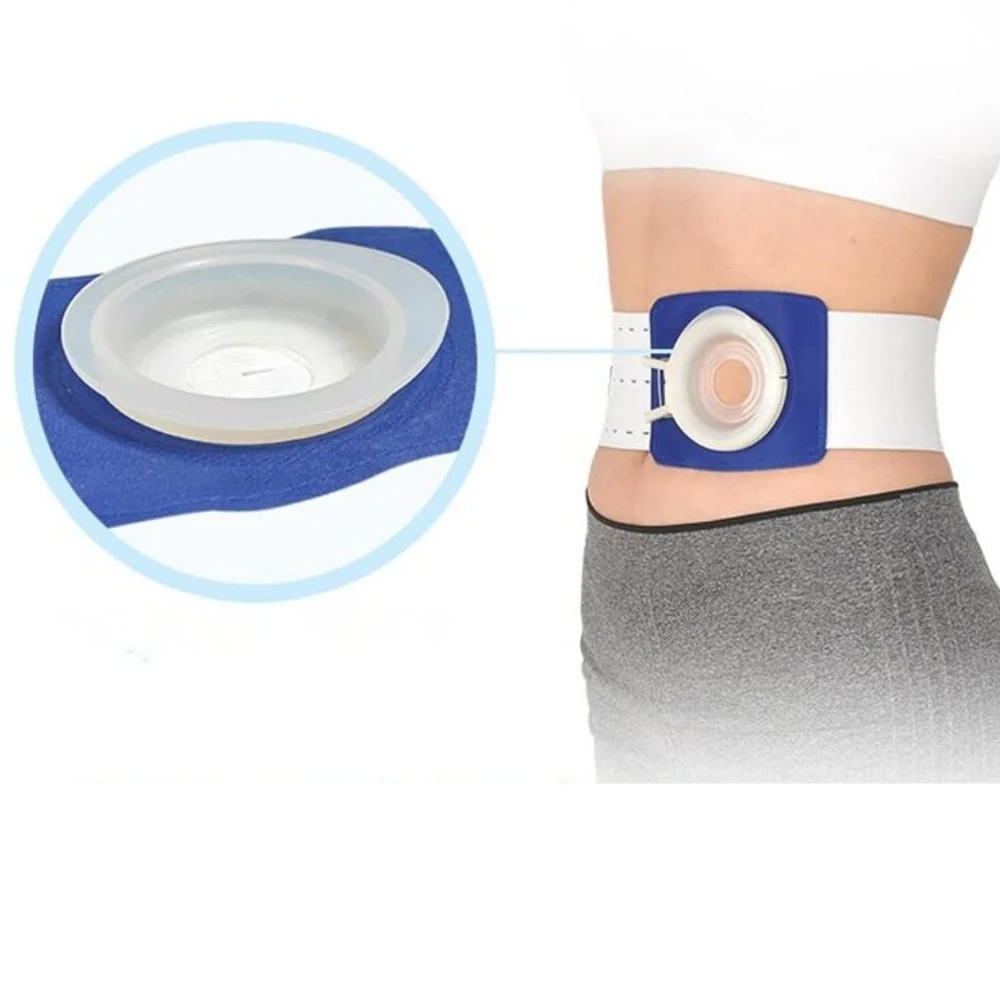 Safe Ostomy Bag Belt For Ileostomy Colonoscopy Urostomy Recyclable
